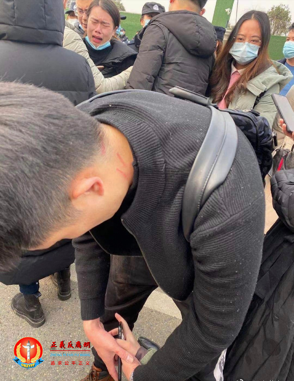 业主被警察暴力抓脖子留下伤痕。.png 业主被警察暴力抓脖子留下伤痕。.png