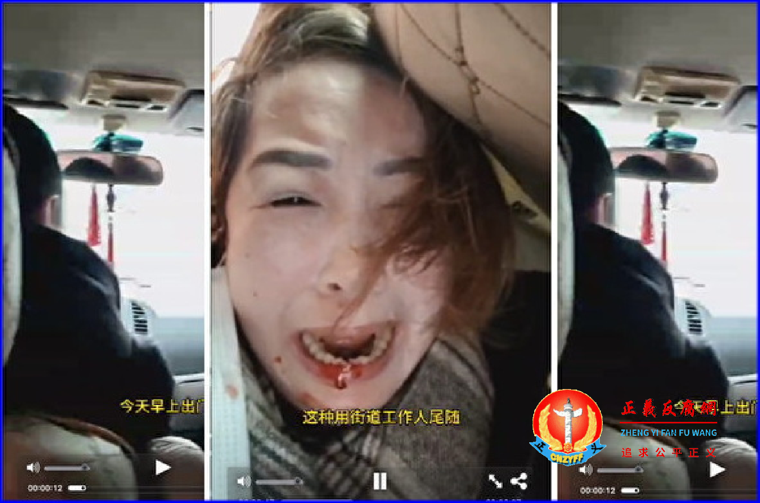 2024年各省各地两会于1月中下旬召开,各地都有访民被暴力维稳事件传出,武汉访民晏凤先被打口鼻流血。.png 2024年各省各地两会于1月中下旬召开,各地都有访民被暴力维稳事件传出,武汉访民晏凤先被打口鼻流血。.png