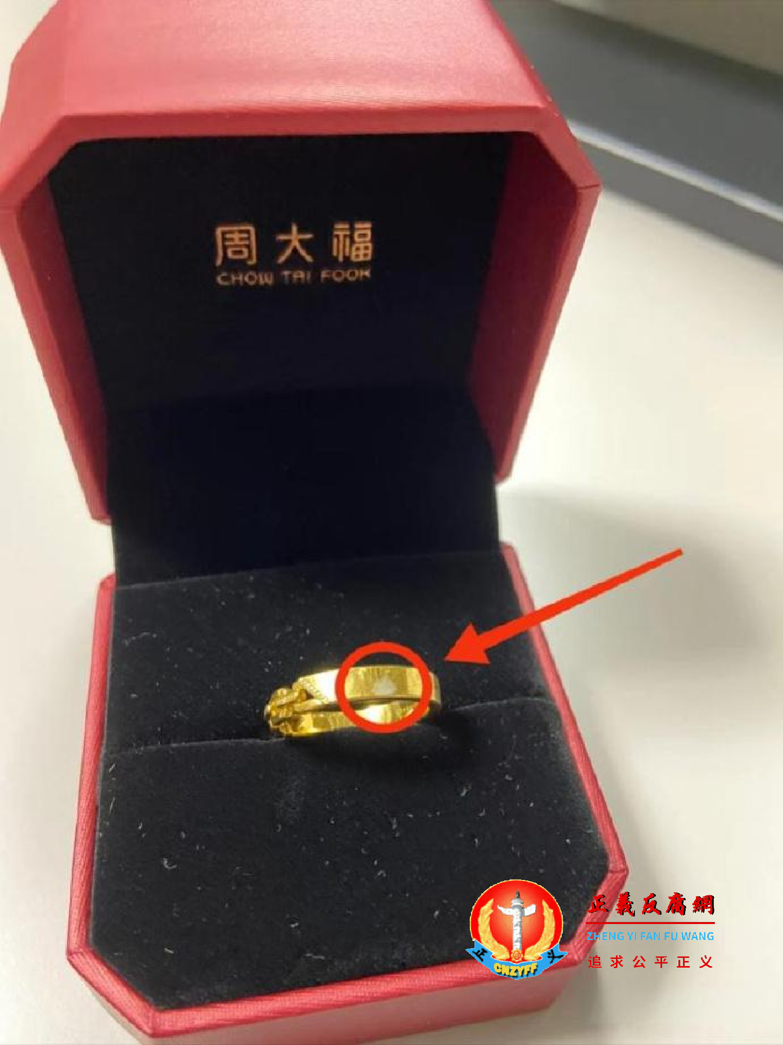 戒指上出现银白色斑块。.png 戒指上出现银白色斑块。.png